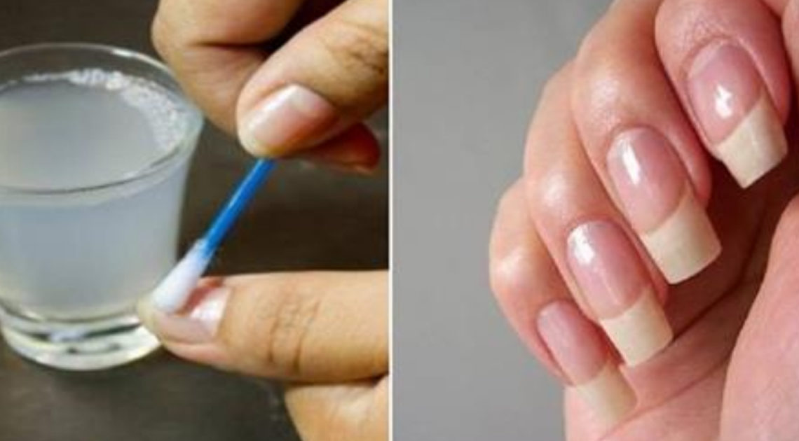 Как отрастить крепкие и красивые ногти