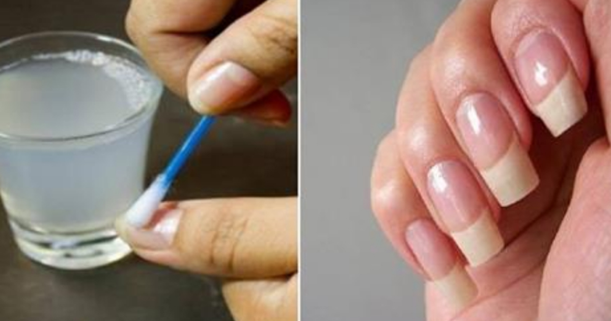 Что делать чтоб ногти
