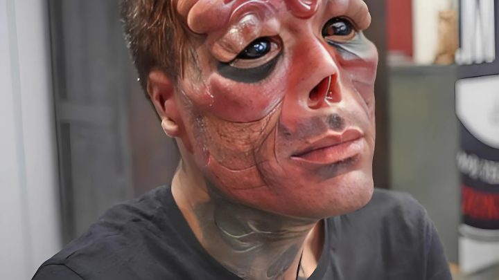 Er schnitt sich die Nase ab, bekam ein Tattoo und Implantate. Warum die Verwandlung?