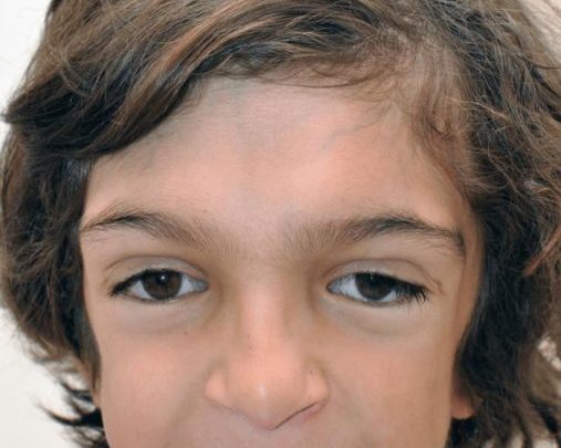 Die Ärzte konnten das Gesicht dieses Jungen wiederherstellen. Sehen Sie nur, wie er heute aussieht.