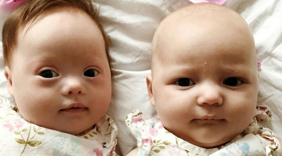 Zwillinge mit einer Chance von eins zu einer Million: Eine hat das Down-Syndrom, die andere nicht!