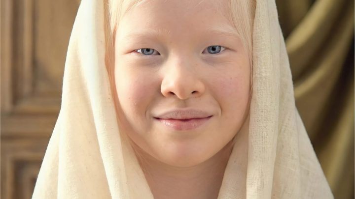 Von der Aussetzung bei der Geburt zum Vogue-Model: Wie Xueli Abbing Schönheit neu definiert und das Bewusstsein für Albinismus schärft