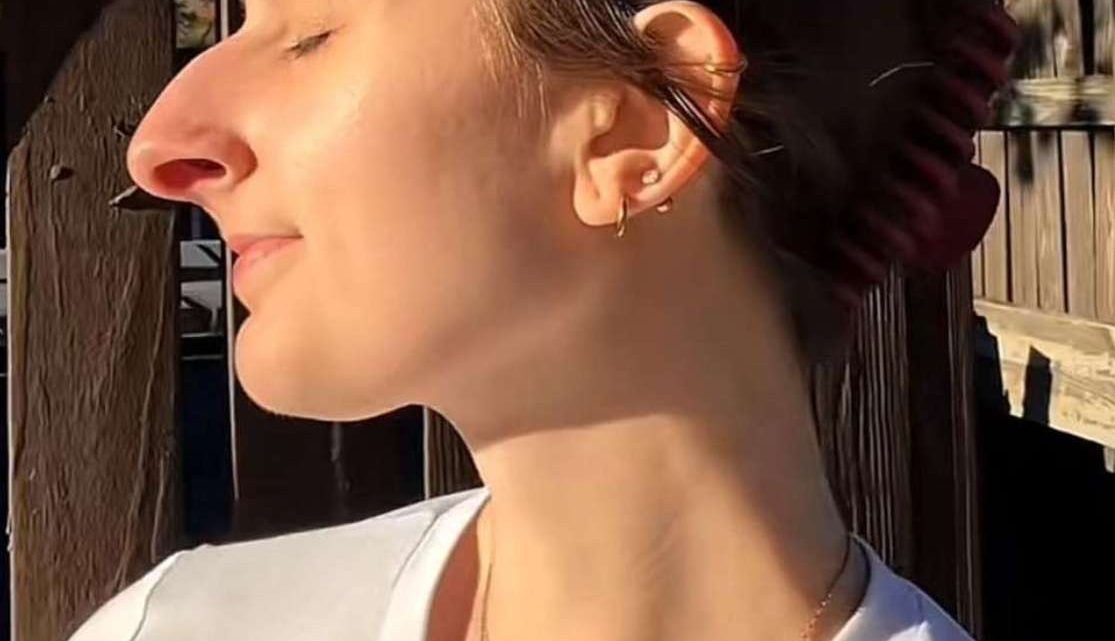 Er sparte 10 Jahre lang, um sich die Nase operieren zu lassen – das Ergebnis schockierte alle.