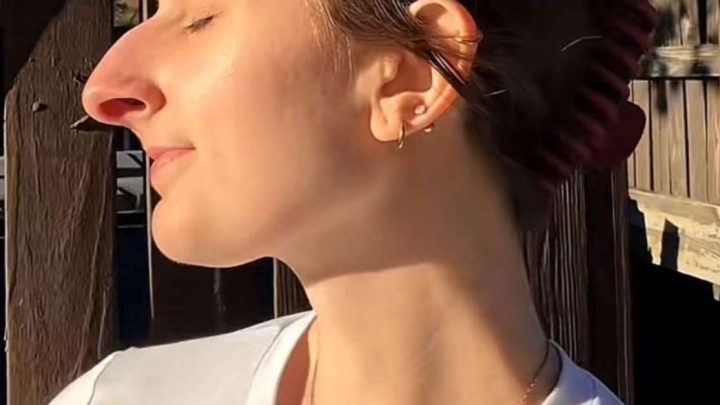 Er sparte 10 Jahre lang, um sich die Nase operieren zu lassen – das Ergebnis schockierte alle.