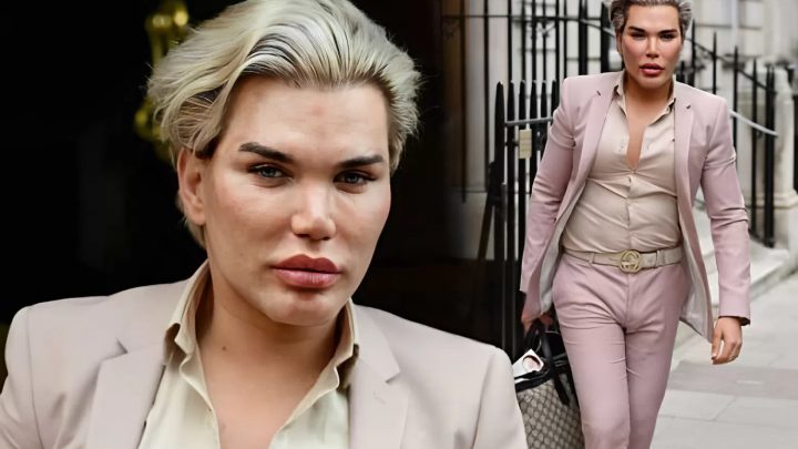 Der frischgebackene Ken zeigte nach 58 Operationen seinen Körper am Strand. Barbie wäre die Kinnlade heruntergefallen…