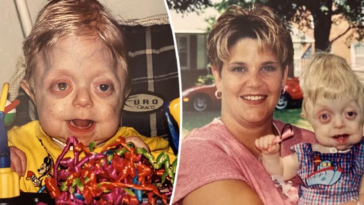 Teenager, dem keine 18 Monate mehr gegeben wurden, macht seinen Highschool-Abschluss