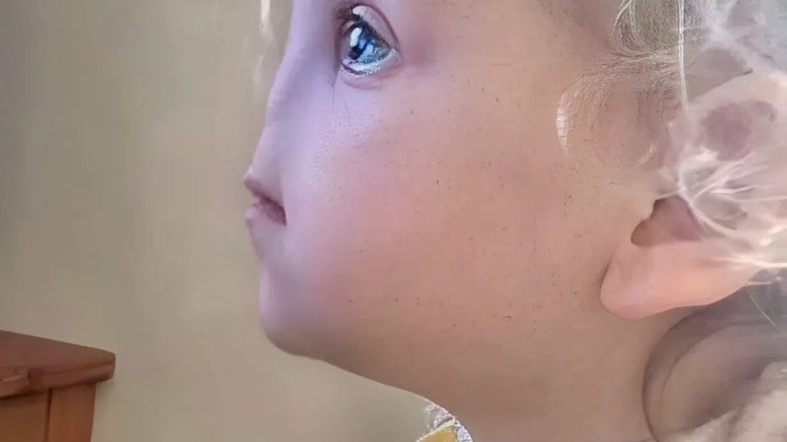 Ohne Nase geboren – so sieht Tessa Evans mit 12 Jahren aus