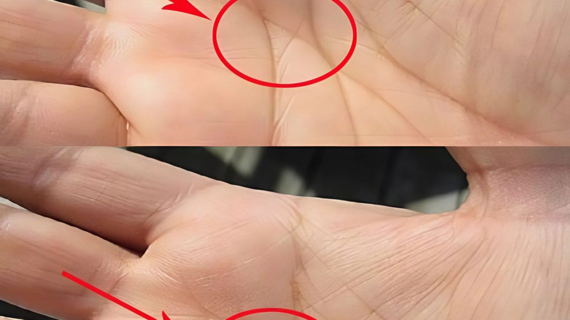 Die Bedeutung der „M“-Linie auf deiner Handfläche in Bezug auf Liebe und Ehe