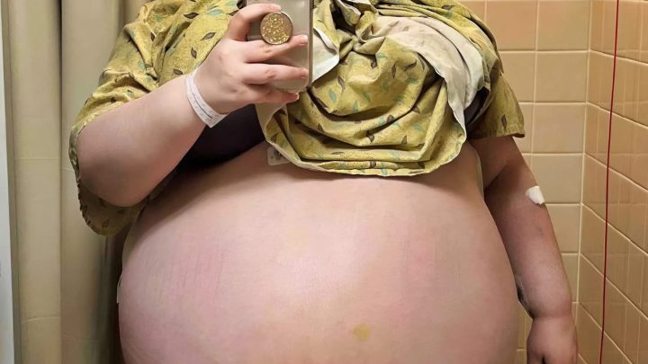 Jahrelang wurde ich von Ärzten beschämt, bis endlich die Wahrheit über meinen Zustand ans Licht kam!: Wie sieht es jetzt aus?