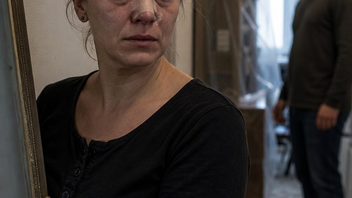 Jahrelang verspotteten mich alle wegen meiner Nase, und als ich mich endlich zu einer Operation entschloss, entfernte mein Mann plötzlich sämtliche Spiegel aus unserem Haus – doch nach einem unerwarteten Klopfen an der Tür erfuhr ich, wer vor vielen Jahren wirklich für meinen schmerzhaftesten Minderwertigkeitskomplex verantwortlich gewesen war … 😱👇😨