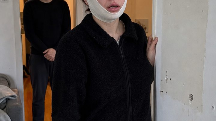 Jahrelang verspotteten mich alle wegen meiner Nase, und als ich mich endlich zu einer Operation entschloss, nahm mein Mann plötzlich jedes Spiegelbild aus unserem Haus – doch ein unerwartetes Klopfen an der Tür enthüllte, wer vor vielen Jahren wirklich für meinen schmerzhaftesten Komplex verantwortlich gewesen war…